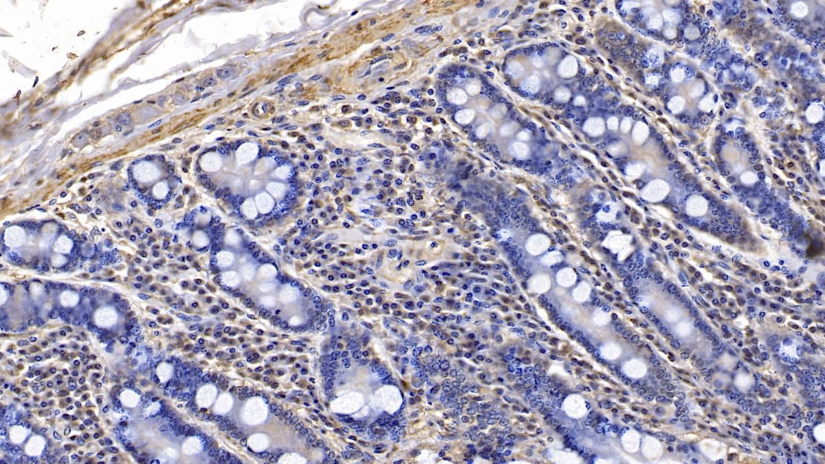 Immunohistochemistry-Paraffin: Actin Alpha 1 Cardiac Muscle Antibody (C4) [NBP3-42196] - DAB staining on IHC-P; Sample: Human Small intestine Tissue; Primary Ab: 10ug/ml NBP3-42196; Second Ab: 2ug/mL HRP-Linked Caprine Anti-Mouse IgG Polyclonal Antibody