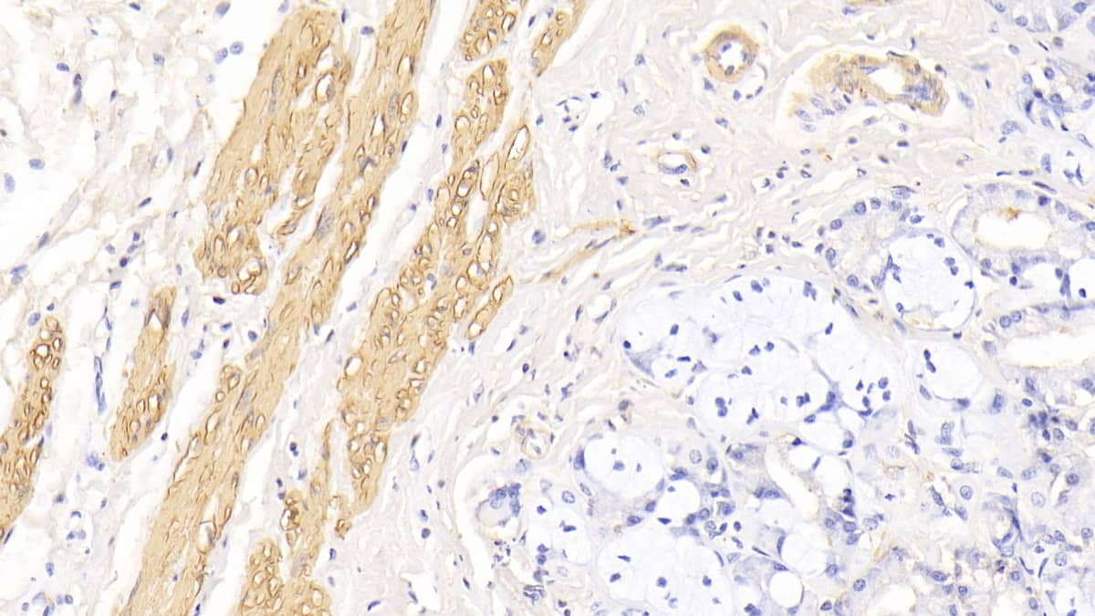 Immunohistochemistry-Paraffin: Actin Alpha 1 Cardiac Muscle Antibody (C302) [NBP3-42197] - DAB staining on IHC-P; Sample: Human Stomach Tissue; Primary Ab: 20ug/ml NBP3-42197; Second Ab: 2ug/mL HRP-Linked Caprine Anti-Mouse IgG Polyclonal Antibody