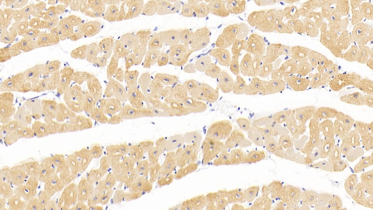 Immunohistochemistry-Paraffin: Actin Alpha 1 Cardiac Muscle Antibody (C302) [NBP3-42197] - DAB staining on IHC-P; Sample: Human Cardiac Muscle Tissue; Primary Ab: 20ug/ml NBP3-42197; Second Ab: 2ug/mL HRP-Linked Caprine Anti-Mouse IgG Polyclonal Antibody