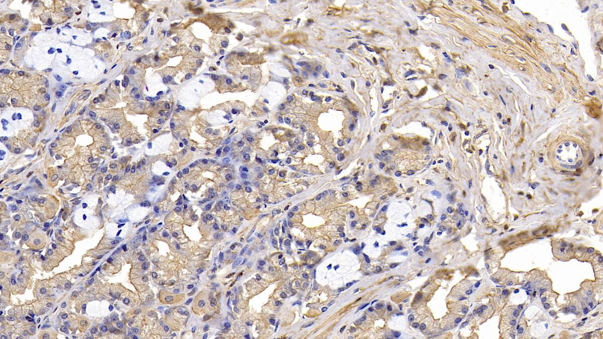 Immunohistochemistry-Paraffin: Actin Alpha 1 Cardiac Muscle Antibody (C6) [NBP3-42198] - DAB staining on IHC-P; Sample: Human Stomach Tissue; Primary Ab: 10ug/ml NBP3-42198; Second Ab: 2ug/mL HRP-Linked Caprine Anti-Mouse IgG Polyclonal Antibody