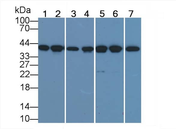 Western Blot: Actin Alpha 1 Cardiac Muscle Antibody (C6) [NBP3-42198] - Sample: Lane1: Mouse Skeletal muscle lysate; Lane2: Porcine Heart lysate; Lane3: Porcine Skeletal muscle lysate; Lane4: Canine Heart lysate; Lane5: Gallus Skeletal muscle lysate; Lane6: Bovine Heart lysate; Lane7: Rabbit Skeletal muscle lysate Primary Ab: 0.5ug/ml NBP3-42198; Second Ab: 0.2ug/mL HRP-Linked Caprine Anti-Mouse IgG Polyclonal Antibody