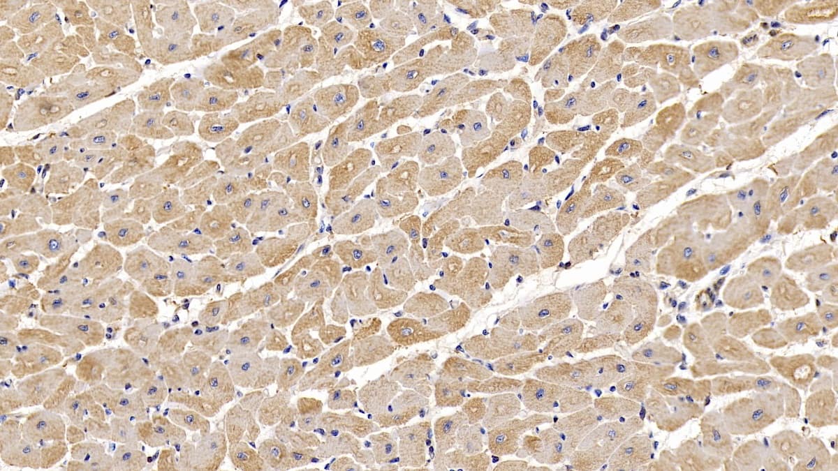 Immunohistochemistry-Paraffin: Actin Alpha 1 Cardiac Muscle Antibody (C6) [NBP3-42198] - DAB staining on IHC-P; Sample: Human Cardiac Muscle Tissue; Primary Ab: 10ug/ml NBP3-42198; Second Ab: 2ug/mL HRP-Linked Caprine Anti-Mouse IgG Polyclonal Antibody