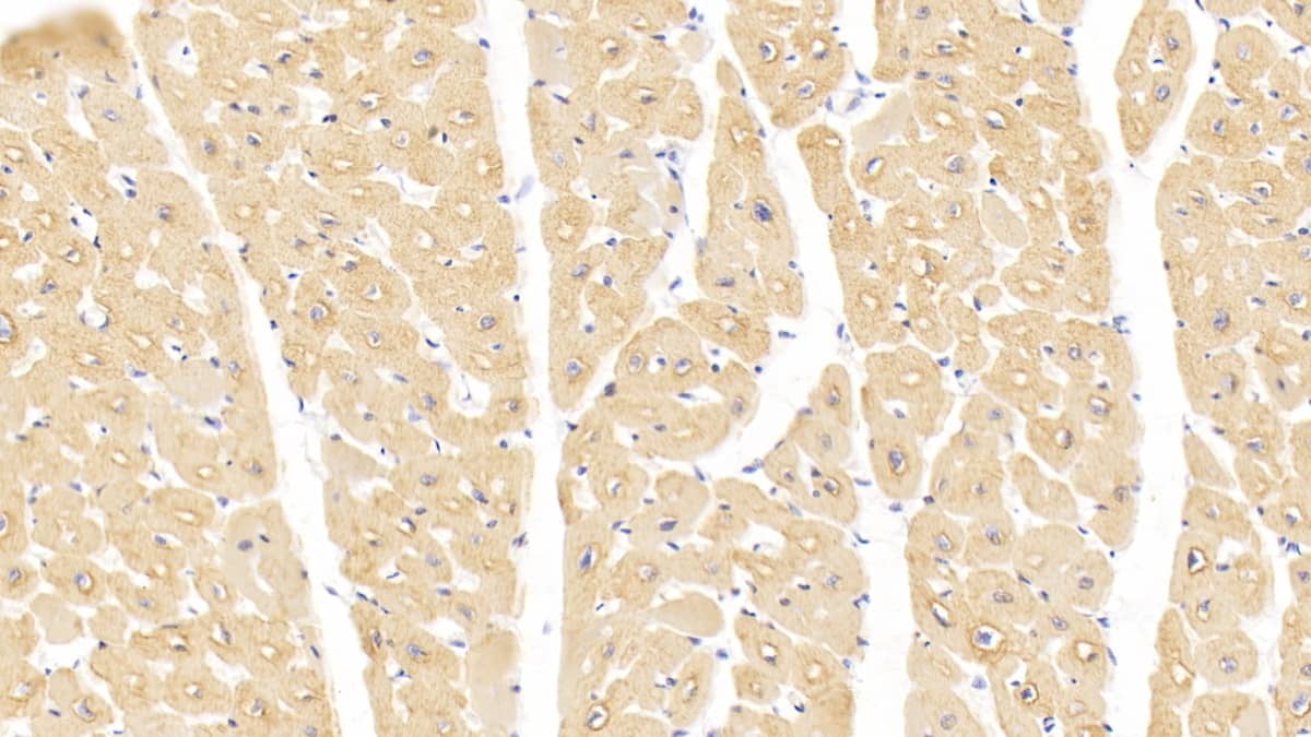 Immunohistochemistry-Paraffin: Actin Alpha 1 Cardiac Muscle Antibody (C304) [NBP3-42199] - DAB staining on IHC-P; Sample: Human Cardiac Muscle Tissue; Primary Ab: 20ug/ml NBP3-42199; Second Ab: 2ug/mL HRP-Linked Caprine Anti-Mouse IgG Polyclonal Antibody