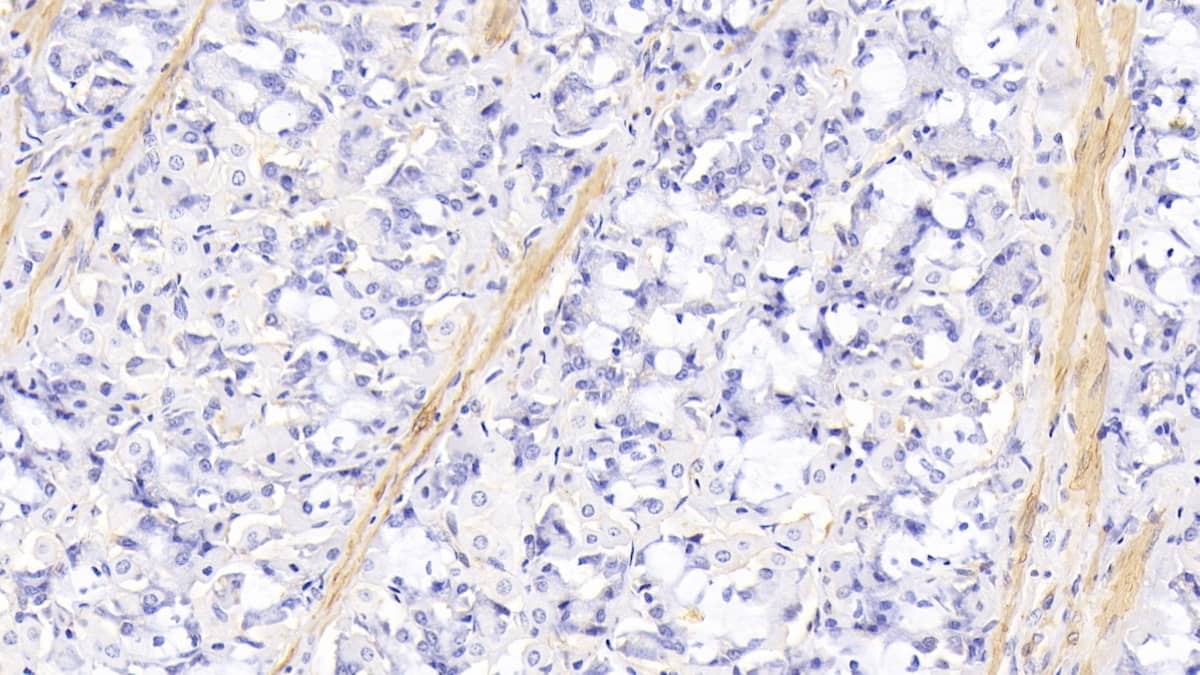 Immunohistochemistry-Paraffin: Actin Alpha 1 Cardiac Muscle Antibody (C304) [NBP3-42199] - DAB staining on IHC-P; Sample: Human Stomach Tissue; Primary Ab: 20ug/ml NBP3-42199; Second Ab: 2ug/mL HRP-Linked Caprine Anti-Mouse IgG Polyclonal Antibody