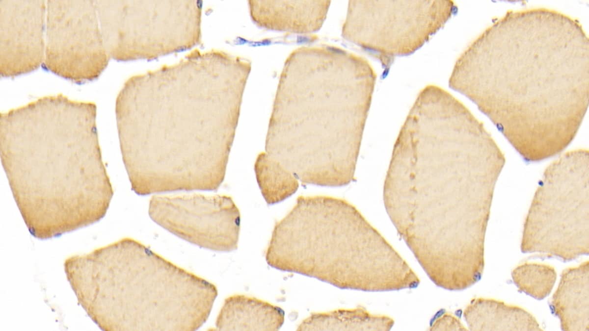 Immunohistochemistry-Paraffin: Actin Alpha 1 Cardiac Muscle Antibody (C304) [NBP3-42199] - DAB staining on IHC-P; Sample: Human Skeletal muscle Tissue; Primary Ab: 20ug/ml NBP3-42199; Second Ab: 2ug/mL HRP-Linked Caprine Anti-Mouse IgG Polyclonal Antibody