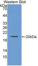 Western Blot LAMC3 Antibody (2#) - BSA Free
