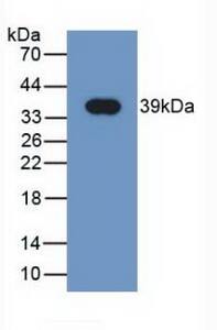 Western Blot: NRG4 Antibody (C2) [NBP3-42202] - Sample: Recombinant NRG4, Human.