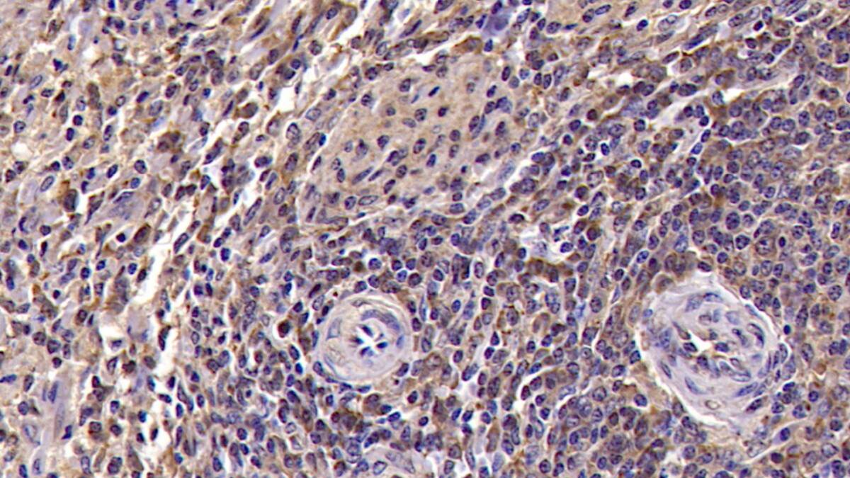 Immunohistochemistry-Paraffin: CD94 Antibody (C2) [NBP3-42203] - DAB staining on IHC-P; Samples: Human Spleen Tissue; Primary Ab: 30ug/ml NBP3-42203; Second Ab: 2ug/mL HRP-Linked Caprine Anti-Mouse IgG Polyclonal Antibody