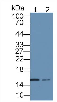 Western Blot: Hemoglobin A1 Antibody (C5) [NBP3-42207] - Sample: Lane1: Rat Cerebrum lysate; Lane2: Rat Heart lysate; Primary Ab: 2ug/ml NBP3-42207; Second Ab: 0.2ug/mL HRP-Linked Rabbit Anti-Mouse IgG Polyclonal Antibody;