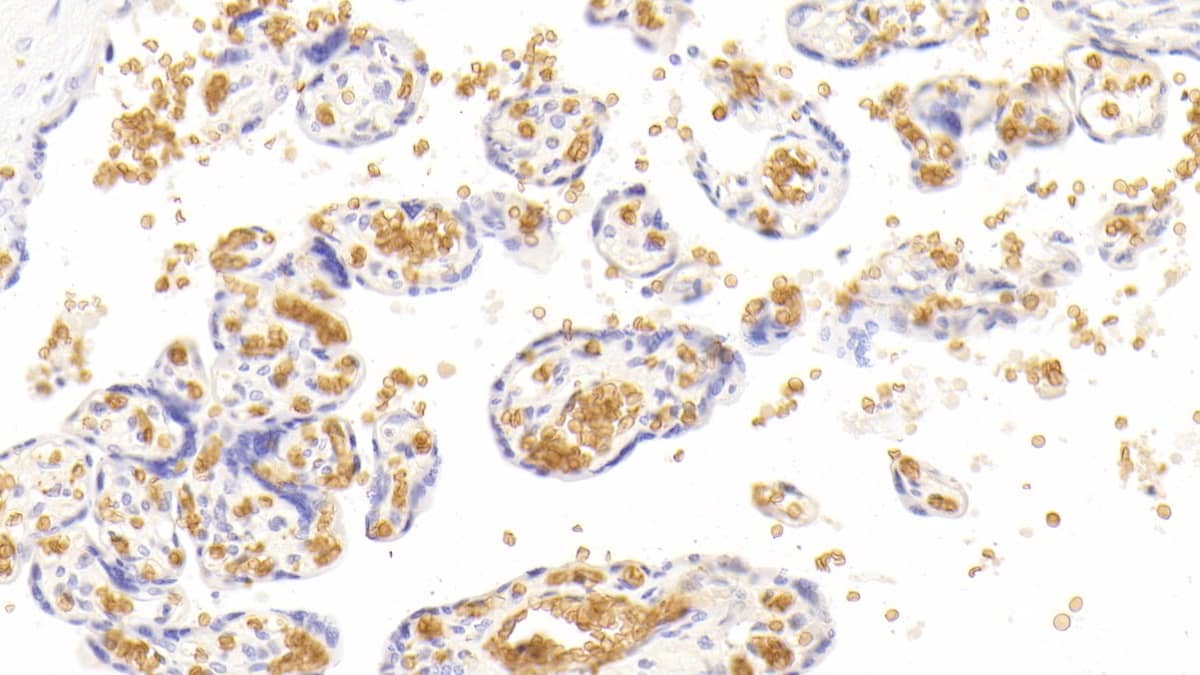 Immunohistochemistry-Paraffin: Hemoglobin A1 Antibody (C5) [NBP3-42207] - DAB staining on IHC-P; Samples: Human Placenta Tissue; Primary Ab: 30ug/ml NBP3-42207; Second Ab: 2ug/mL HRP-Linked Caprine Anti-Mouse IgG Polyclonal Antibody