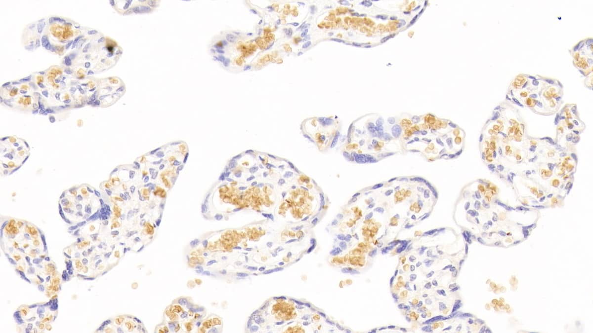 Immunohistochemistry-Paraffin: Hemoglobin A1 Antibody (C6) [NBP3-42208] - DAB staining on IHC-P; Sample: Human Placenta Tissue; Primary Ab: 30ug/ml NBP3-42208; Second Ab: 2ug/mL HRP-Linked Caprine Anti-Mouse IgG Polyclonal Antibody