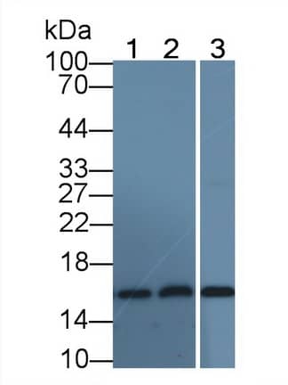 Western Blot: Hemoglobin A1 Antibody (C6) [NBP3-42208] - Sample: Lane1: Human Serum; Lane2: Rat Liver lysate; Lane3: Rat Cerebrum lysate Primary Ab: 2ug/ml NBP3-42208; Second Ab: 0.2ug/mL HRP-Linked Caprine Anti-Mouse IgG Polyclonal Antibody