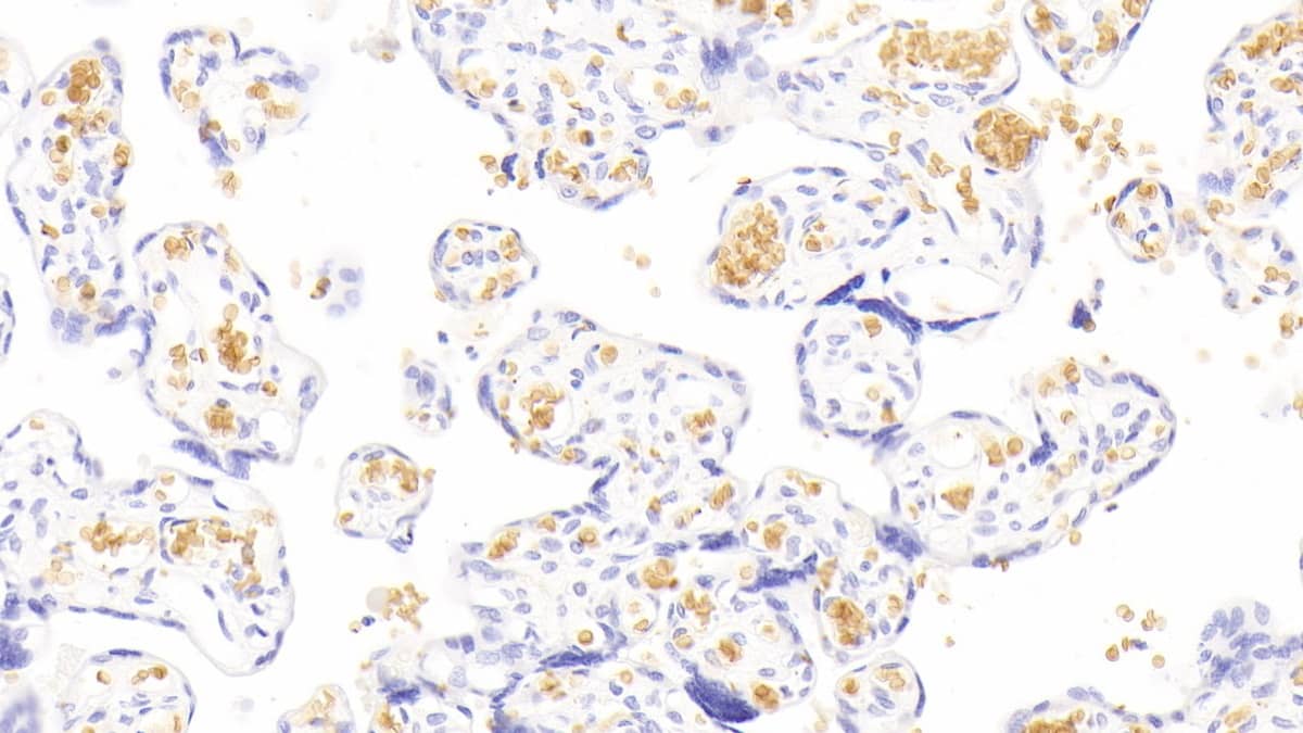 Immunohistochemistry-Paraffin: Hemoglobin A1 Antibody (C7) [NBP3-42212] - DAB staining on IHC-P; Sample: Human Placenta Tissue; Primary Ab: 30ug/ml NBP3-42212; Second Ab: 2ug/mL HRP-Linked Caprine Anti-Mouse IgG Polyclonal Antibody