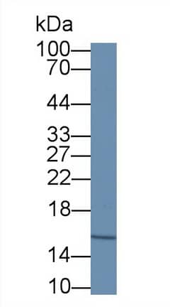 Western Blot: Hemoglobin A1 Antibody (C7) [NBP3-42212] - Sample: Human Serum Primary Ab: 2ug/ml NBP3-42212; Second Ab: 0.2ug/mL HRP-Linked Caprine Anti-Mouse IgG Polyclonal Antibody