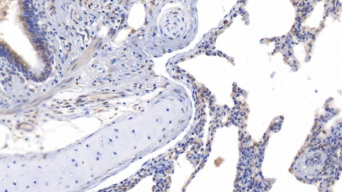 Immunohistochemistry-Paraffin: Asprosin Antibody [NBP3-42216] - DAB staining on IHC-P; Samples: Human Lung Tissue; Primary Ab: 20ug/ml NBP3-42216; Second Ab: 2ug/mL HRP-Linked Caprine Anti-Rabbit IgG Polyclonal Antibody