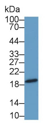 Western Blot: C1orf194 Antibody [NBP3-42219] - Sample: Mouse Testis lysate Primary Ab: 2ug/ml NBP3-42219; Second Ab: 0.2ug/mL HRP-Linked Caprine Anti-Rabbit IgG Polyclonal Antibody