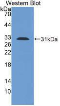 Western Blot: TLR1 Antibody (8-3#) [NBP3-42220] - Sample: Recombinant TLR1, Human.