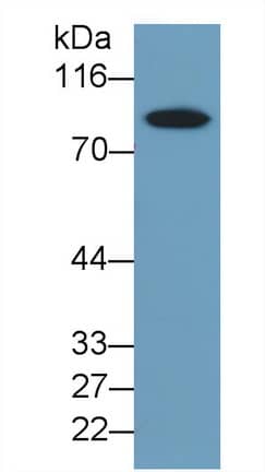 Western Blot: Thrombin-antithrombin (TAT) complexes Antibody (C1) [NBP3-42226] - Sample: Human Serum Primary Ab: 0.2ug/ml NBP3-42226; Second Ab: 0.2ug/mL HRP-Linked Caprine Anti-Mouse IgG Polyclonal Antibody