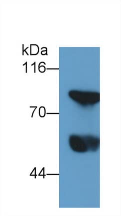 Western Blot: Thrombin-antithrombin (TAT) complexes Antibody (C4) [NBP3-42227] - Sample: Human Serum Primary Ab: 0.2ug/ml NBP3-42227; Second Ab: 0.2ug/mL HRP-Linked Caprine Anti-Mouse IgG Polyclonal Antibody