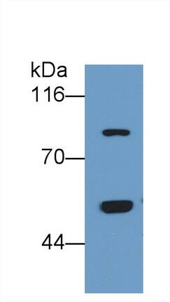 Western Blot: Thrombin-antithrombin (TAT) complexes Antibody (C7) [NBP3-42228] - Sample: Human Serum Primary Ab: 0.2ug/ml NBP3-42228; Second Ab: 0.2ug/mL HRP-Linked Caprine Anti-Mouse IgG Polyclonal Antibody