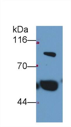 Western Blot: Thrombin-antithrombin (TAT) complexes Antibody (C3) [NBP3-42229] - Sample: Human Serum Primary Ab: 0.2ug/ml NBP3-42229; Second Ab: 0.2ug/mL HRP-Linked Caprine Anti-Mouse IgG Polyclonal Antibody