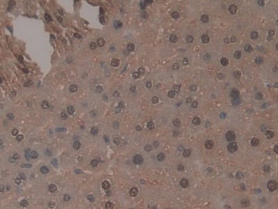 Immunohistochemistry-Paraffin TNP1 Antibody