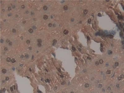 Immunohistochemistry-Paraffin TNP1 Antibody