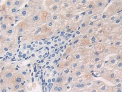 Immunohistochemistry-Paraffin: Calcineurin Antibody [NBP3-42331] - DAB staining on IHC-P; Samples: Human Liver Tissue; Primary Ab: 10ug/ml NBP3-42331; Second Ab: 2ug/mL HRP-Linked Caprine Anti-Rabbit IgG Polyclonal Antibody