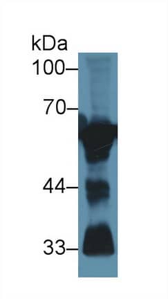 Western Blot: Calcineurin Antibody [NBP3-42331] - Sample: Mouse Cerebrum lysate; Primary Ab: 1ug/ml NBP3-42331; Second Ab: 0.2ug/mL HRP-Linked Caprine Anti-Rabbit IgG Polyclonal Antibody