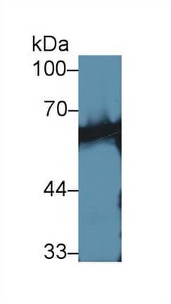 Western Blot: Calcineurin Antibody [NBP3-42331] - Sample: Mouse Skeletal muscle lysate; Primary Ab: 1ug/ml NBP3-42331; Second Ab: 0.2ug/mL HRP-Linked Caprine Anti-Rabbit IgG Polyclonal Antibody