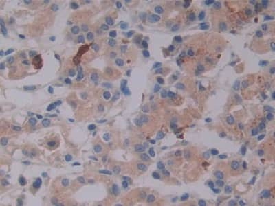 Immunohistochemistry-Paraffin: Latent TGF-beta bp2/LTBP-2 Antibody [NBP3-42333] - DAB staining on IHC-P; Samples: Human Stomach Tissue; Primary Ab: 10ug/ml NBP3-42333; Second Ab: 2ug/mL HRP-Linked Caprine Anti-Rabbit IgG Polyclonal Antibody