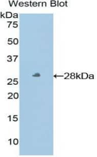 Western Blot: HLA-E Antibody [NBP3-42334] - Sample: Recombinant protein.