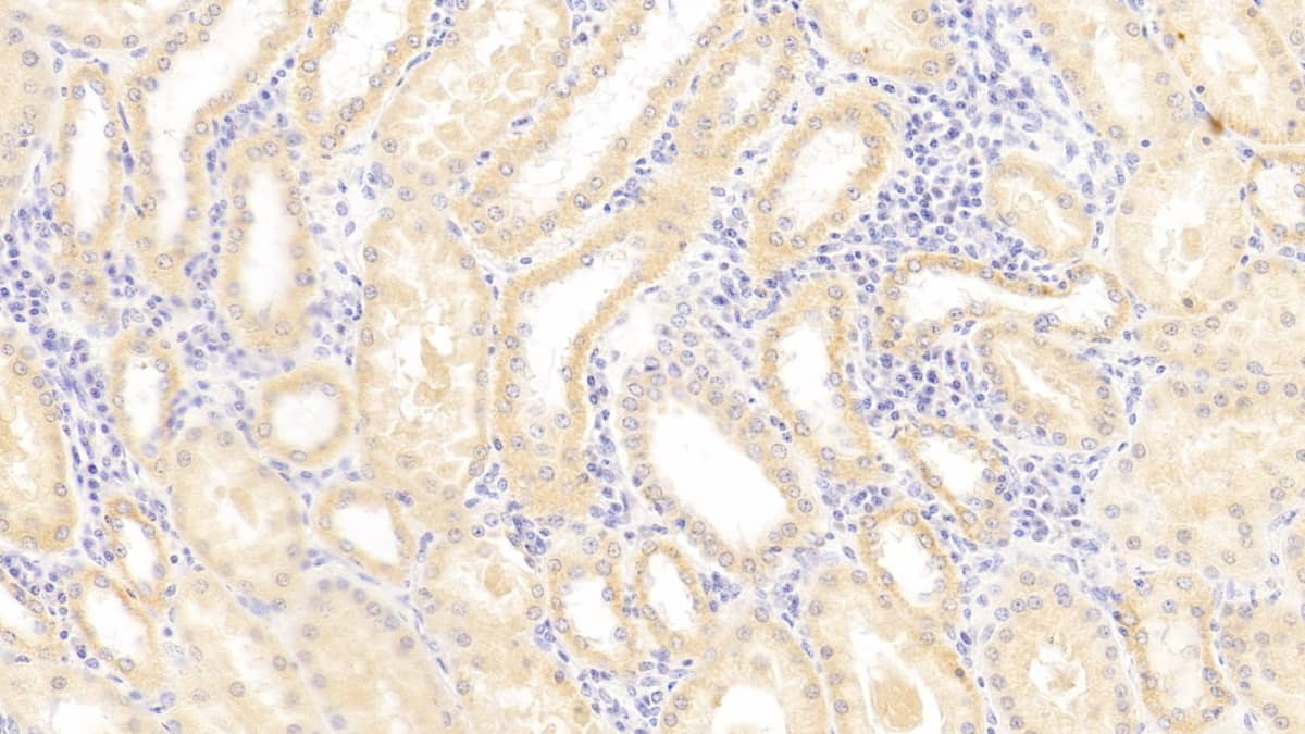 Immunohistochemistry-Paraffin: HLA-E Antibody [NBP3-42334] - DAB staining on IHC-P; Samples: Human Kidney Tissue; Primary Ab: 30ug/ml NBP3-42334; Second Ab: 2ug/mL HRP-Linked Caprine Anti-Rabbit IgG Polyclonal Antibody