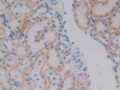 Immunohistochemistry-Paraffin: Plakophilin 1 Antibody [NBP3-42336] - DAB staining on IHC-P; Samples: Human Kidney Tissue; Primary Ab: 10ug/ml NBP3-42336