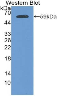 Western Blot: Plakophilin 1 Antibody [NBP3-42336] - Sample: Recombinant protein.