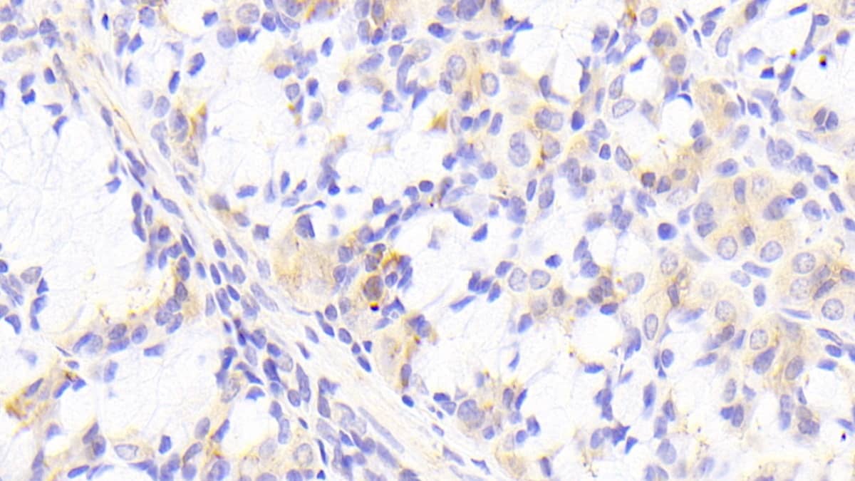 Immunohistochemistry-Paraffin: PTPRK Antibody [NBP3-42343] - DAB staining on IHC-P; Samples: Human Stomach Tissue; Primary Ab: 20ug/ml NBP3-42343; Second Ab: 2ug/mL HRP-Linked Caprine Anti-Rabbit IgG Polyclonal Antibody