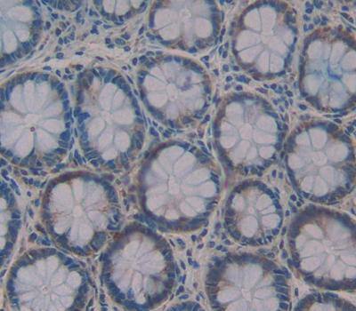 Immunohistochemistry-Paraffin: Gastrin-releasing Peptide/Bombesin/Neuromedin C Antibody [NBP3-42344] - Used in DAB staining on fromalin fixed paraffin- embedded Kidney tissue