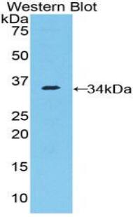 Western Blot: NUP205 Antibody [NBP3-42345] - Sample: Recombinant protein.