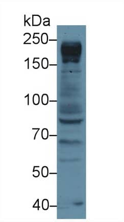 Western Blot: NUP205 Antibody [NBP3-42345] - Sample: Human Jurkat cell lysate; Primary Ab: 3ug/ml NBP3-42345; Second Ab: 0.2ug/mL HRP-Linked Caprine Anti-Rabbit IgG Polyclonal Antibody