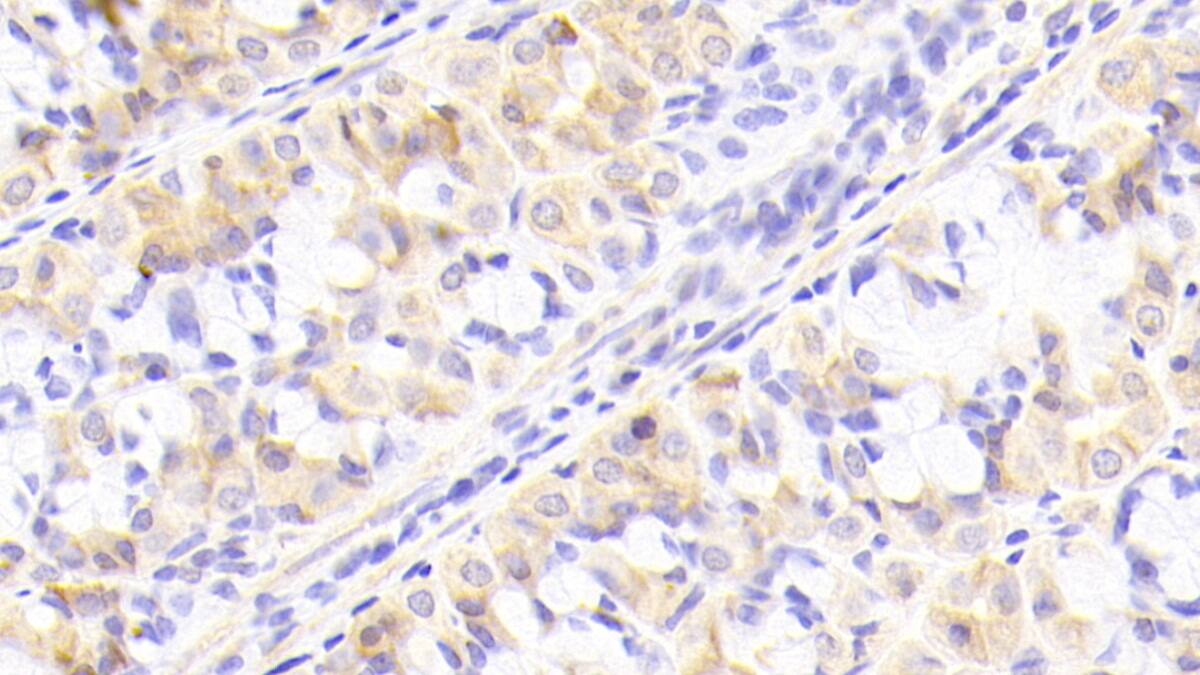 Immunohistochemistry-Paraffin NUP205 Antibody