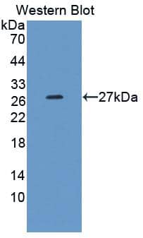 Western Blot MMP21 Antibody