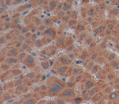 Immunohistochemistry-Paraffin MMP21 Antibody