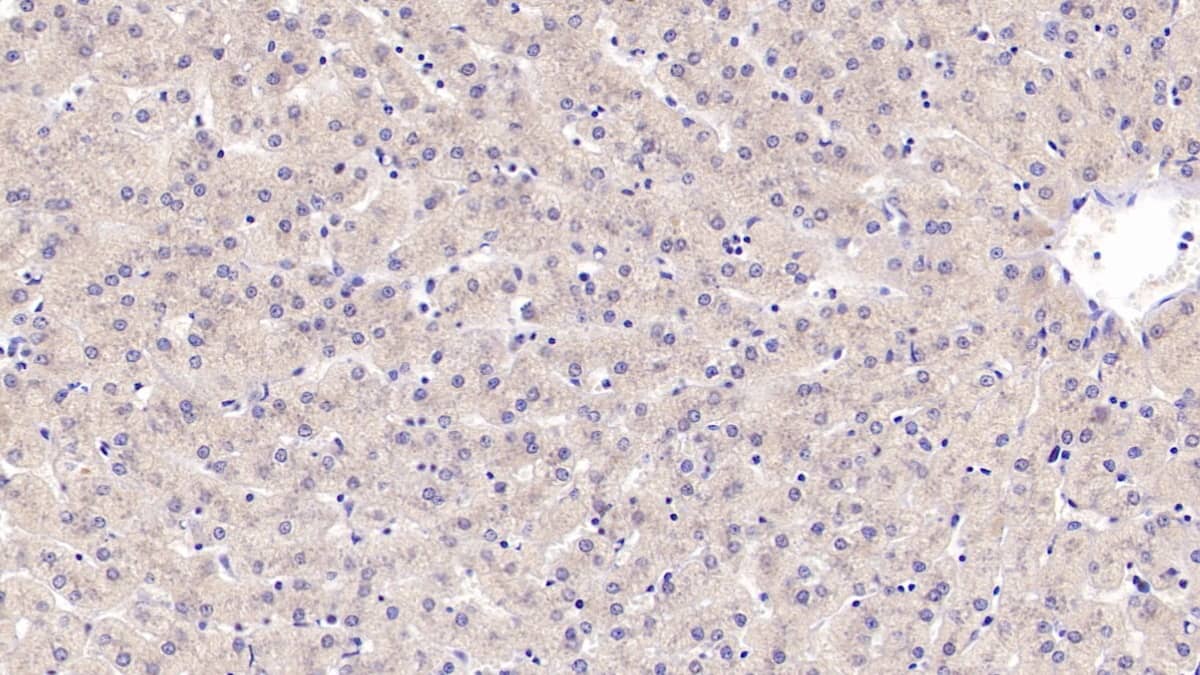 Immunohistochemistry-Paraffin: CCL23/Ck beta 8-1/MIP3 Antibody [NBP3-42350] - DAB staining on IHC-P; Samples: Human Liver Tissue; Primary Ab: 10ug/ml NBP3-42350; Second Ab: 2ug/mL HRP-Linked Caprine Anti-Rabbit IgG Polyclonal Antibody
