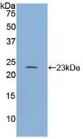 Western Blot: RGS4 Antibody [NBP3-42351] - Sample: Recombinant RGS4, Human.