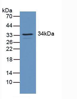 Western Blot: RGS4 Antibody [NBP3-42351] - Sample: Mouse Brain Tissue.