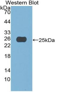 Western Blot: ACF Antibody [NBP3-42352] - Sample: Recombinant ACF, Human.