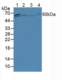 Western Blot: ACF Antibody [NBP3-42352] - Sample: Lane1: Porcine Liver Tissue; Lane2: Human Hela Cells; Lane3: Human Jurkat Cells; Lane4: Human 293T Cells.