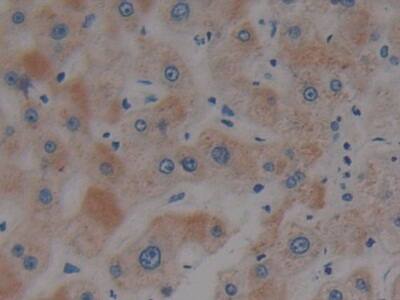 Immunohistochemistry-Paraffin: Plakophilin 2 Antibody [NBP3-42354] - DAB staining on IHC-P; Samples: Human Liver Tissue; Primary Ab: 10ug/ml NBP3-42354; Second Ab: 2ug/mL HRP-Linked Caprine Anti-Rabbit IgG Polyclonal Antibody