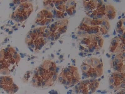 Immunohistochemistry-Paraffin: Plakophilin 2 Antibody [NBP3-42354] - DAB staining on IHC-P; Samples: Human Stomach Tissue; Primary Ab: 10ug/ml NBP3-42354; Second Ab: 2ug/mL HRP-Linked Caprine Anti-Rabbit IgG Polyclonal Antibody