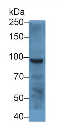 Western Blot: Plakophilin 2 Antibody [NBP3-42354] - Sample: Cavia Salivary gland lysate Primary Ab: 5ug/ml NBP3-42354; Second Ab: 0.2ug/mL HRP-Linked Caprine Anti-Rabbit IgG Polyclonal Antibody